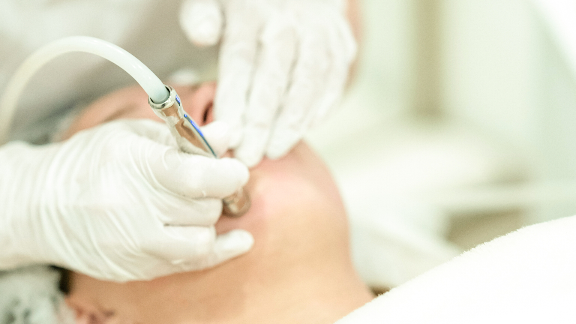 microdermabrasion-services